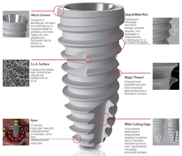 Имплантат IS-III Active Fixture